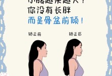 骨盆前倾纠正法（探索最有效的骨盆前倾纠正方法，恢复正确的身体姿态！）